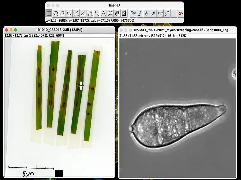 ImageJ Free USB Microscope Software